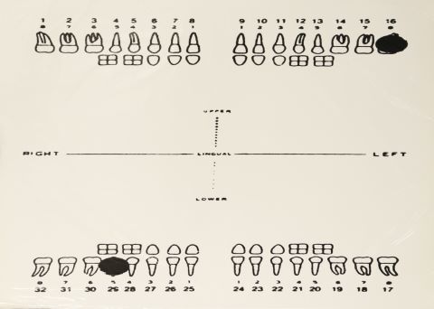 Divers Ensemble de 8 sérigraphies