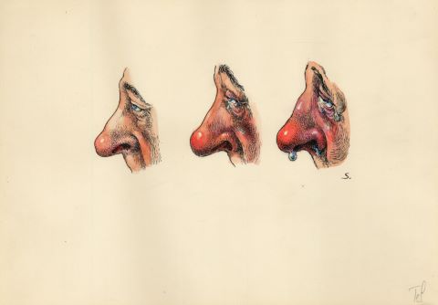 Éternuement & nez qui coule [2 œuvres]